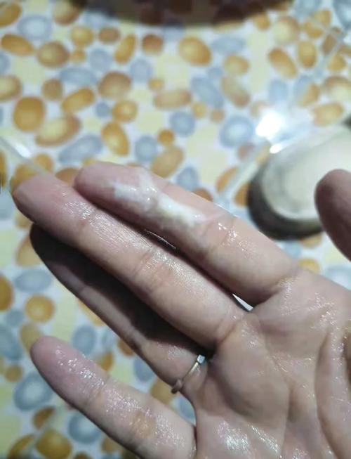 白带像豆腐渣一样怎么办