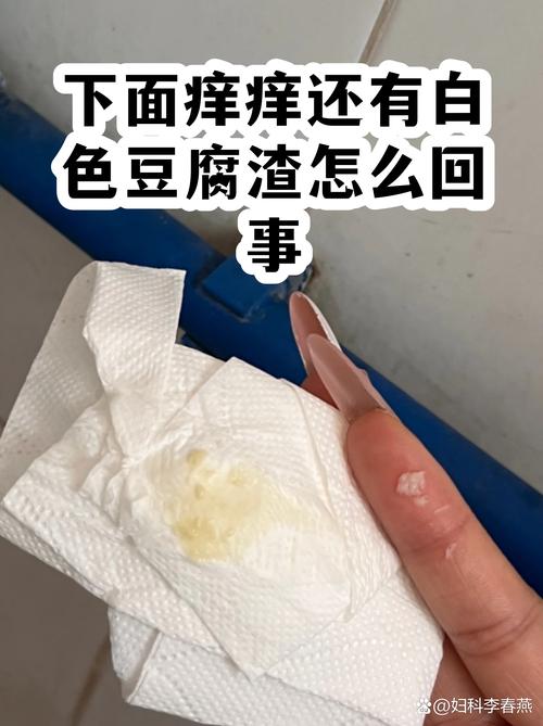 白带像豆腐渣一样怎么办