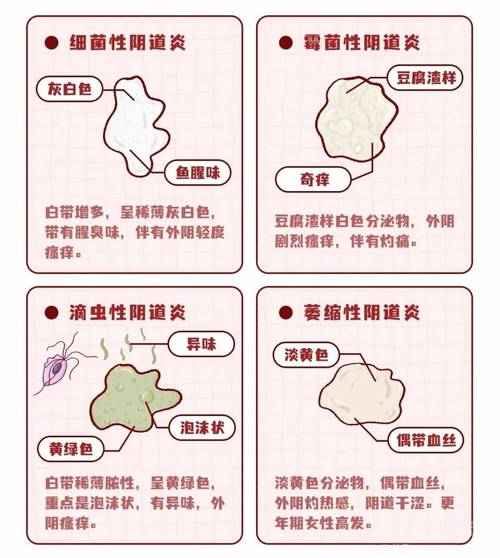 阴道炎治疗后多久复查白带