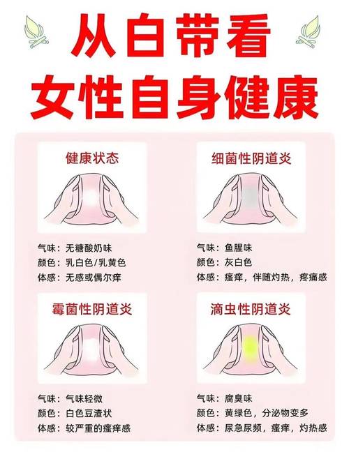 阴道炎治疗后多久复查白带
