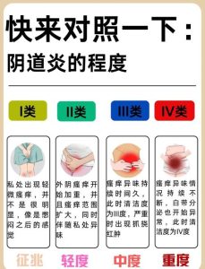 妇科炎症和内衣材质有关系吗?-两性知识丨两性健康--你想了解的我都知道