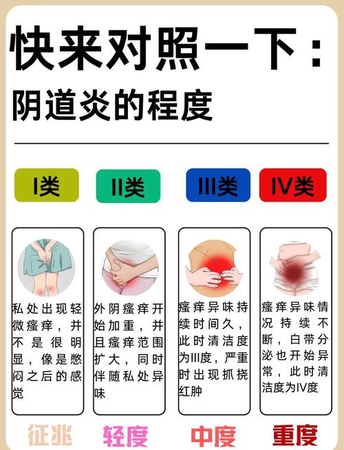 妇科炎症和内衣材质有关系吗