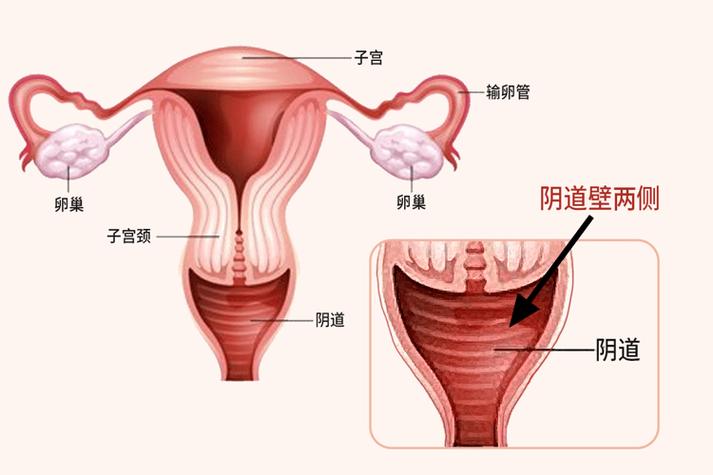 阴道有气排出是正常的吗