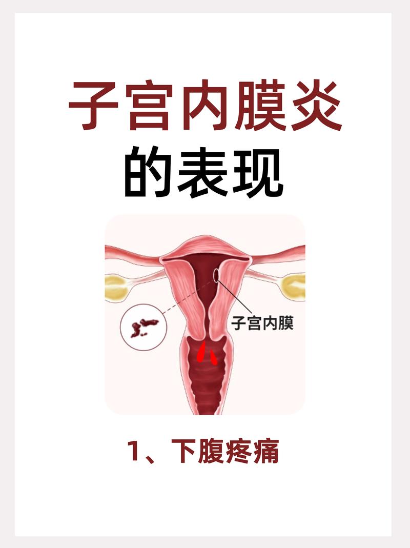 子宫内膜炎有什么表现