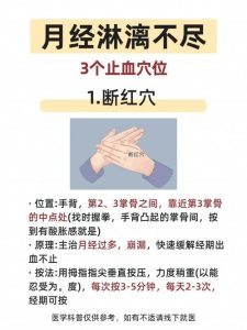 月经期能做针灸吗?一文说清经期针灸的禁忌与注意事项-两性知识丨两性健康--你想了解的我都知道