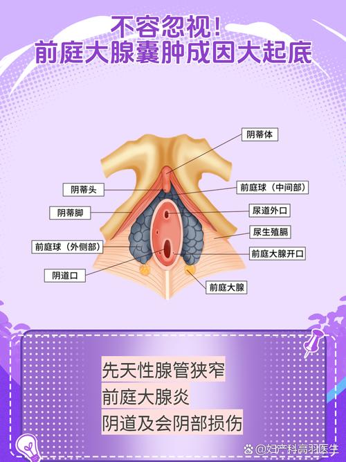前庭大腺囊肿需要手术吗