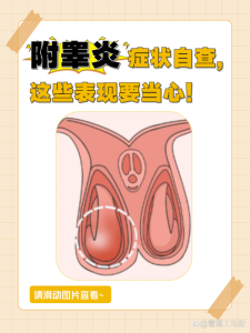 附睾炎有什么症状？身体会发出这些信号-两性知识丨两性健康--你想了解的我都知道
