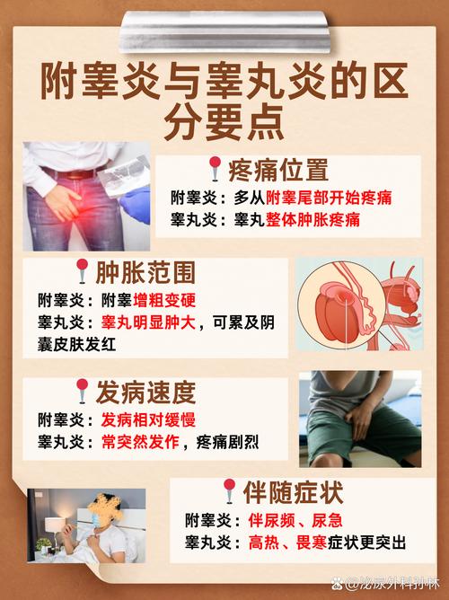 附睾炎有什么症状