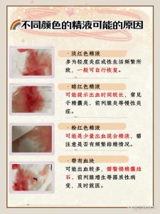 血精是什么原因引起的？这到底要不要紧？-两性知识丨两性健康--你想了解的我都知道