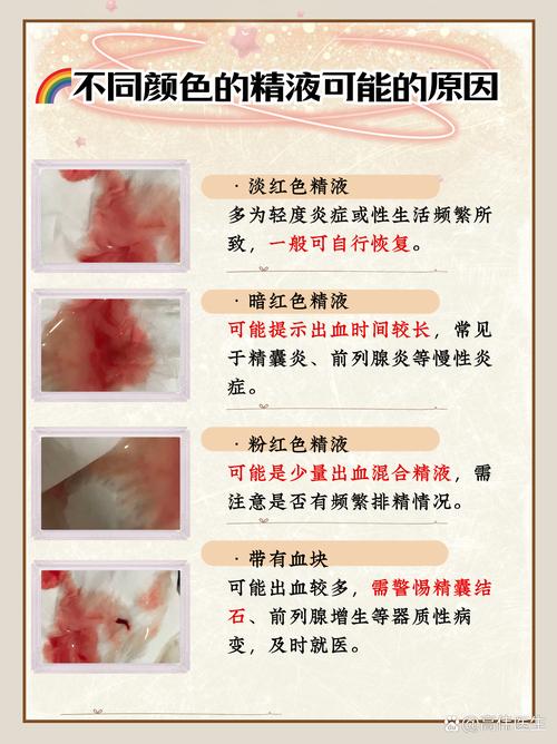 血精是什么原因引起的