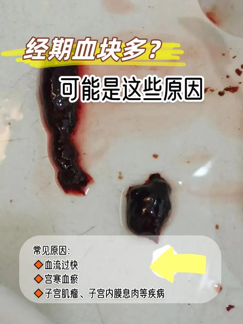 经期出现血块多大要就医