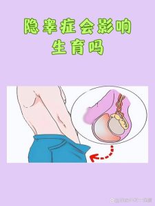 隐睾没治会影响生育吗?看完这篇心里就有数了-两性知识丨两性健康--你想了解的我都知道