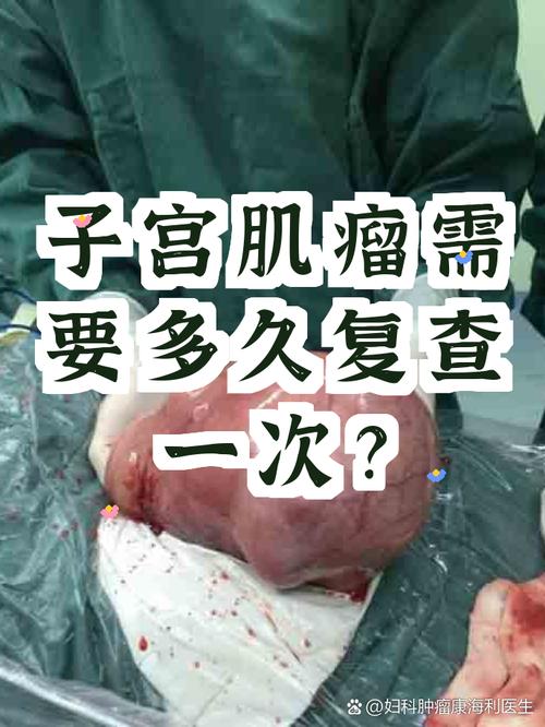 子宫肌瘤多久复查一次