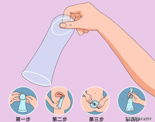 避孕套需要全程佩戴吗