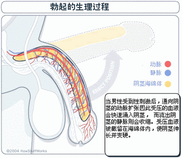 阴茎勃起角度异常要紧吗