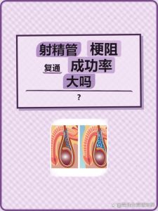 男性射精管梗阻能治疗吗-两性知识丨两性健康--你想了解的我都知道