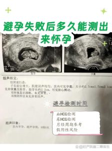 避孕失败后多久能测出怀孕?别慌,看这篇就懂了-两性知识丨两性健康--你想了解的我都知道