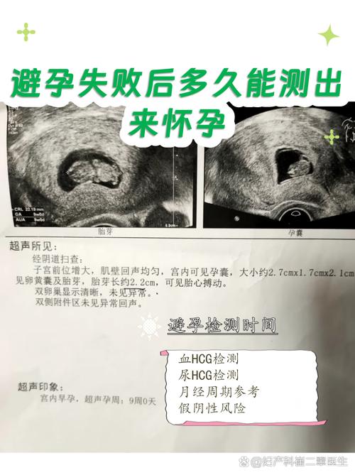 避孕失败后多久能测出怀孕