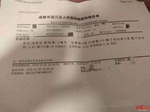男性结扎后，是不是还得去医院查精液？-两性知识丨两性健康--你想了解的我都知道