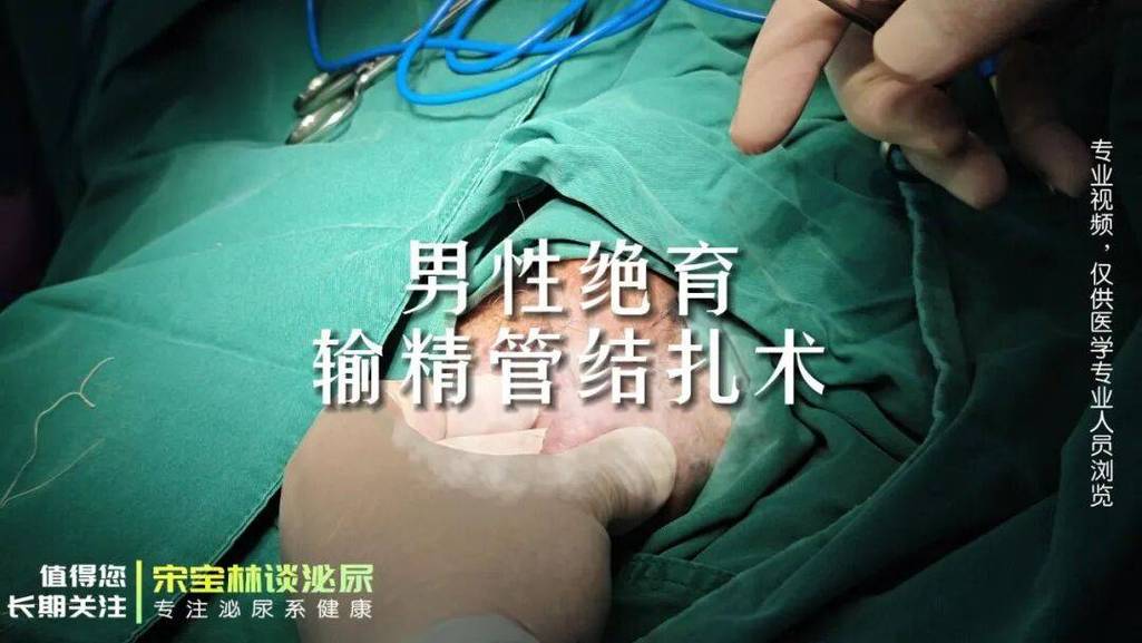 男性结扎后要复查精液吗