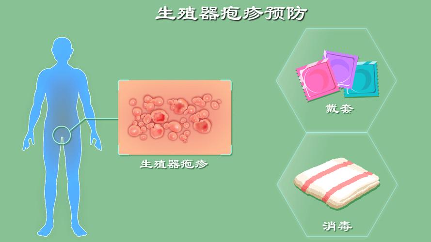 生殖器疱疹发作前有感觉吗