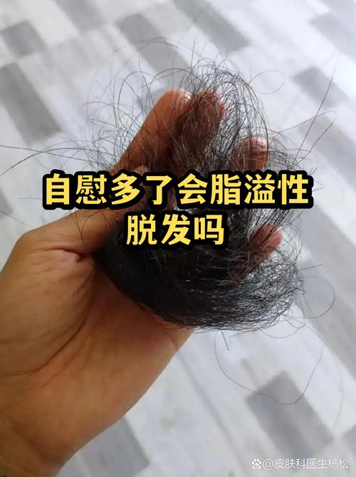自慰会导致脱发吗
