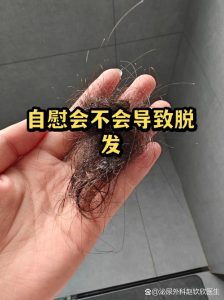 自慰会导致脱发吗?很多人担心的事一次说清楚-两性知识丨两性健康--你想了解的我都知道
