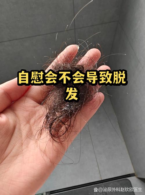 自慰会导致脱发吗