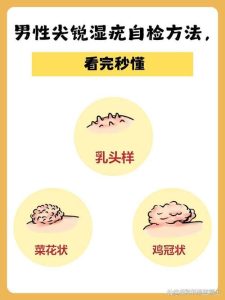 男性乳头有分泌物是病吗?-两性知识丨两性健康--你想了解的我都知道