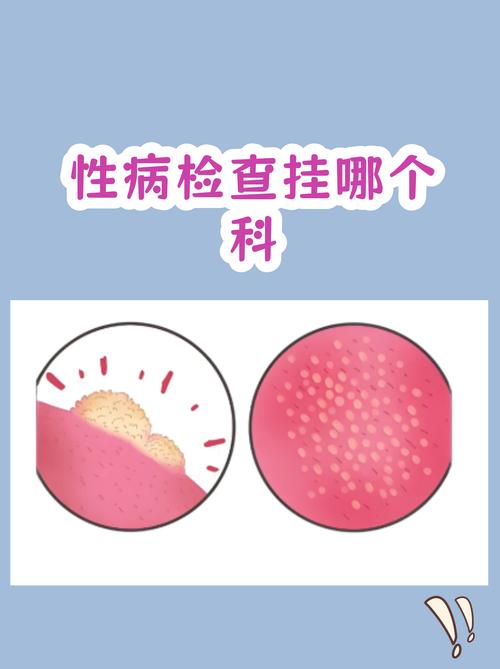 性病复查挂什么科