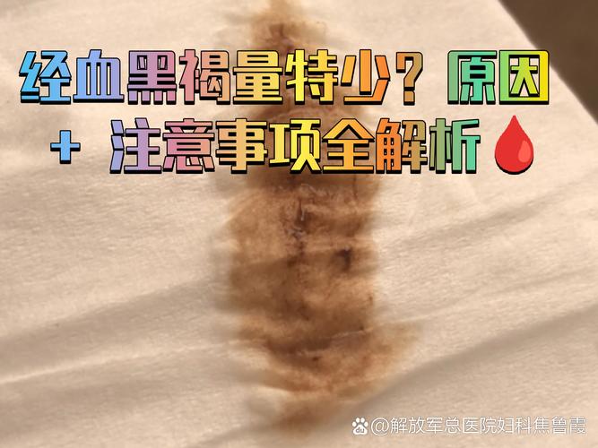 月经颜色发黑需要担心吗