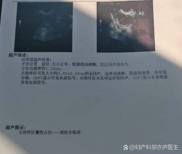 卵巢功能减退要查卵巢血流吗
