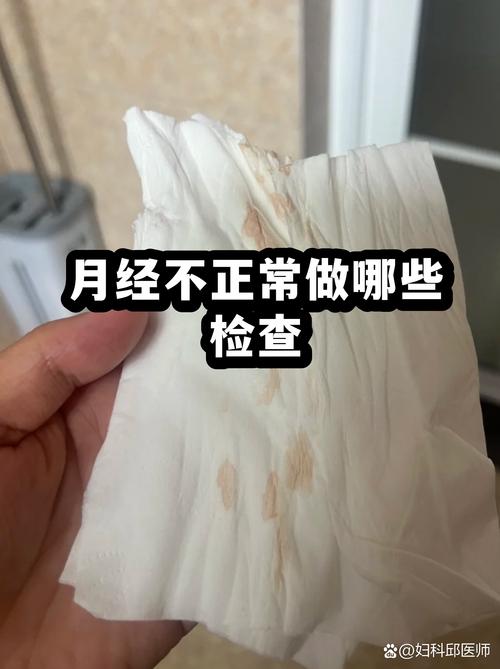 月经不规律需要做哪些检查