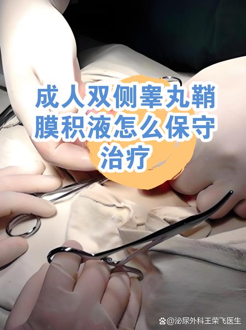 睾丸鞘膜积液需要手术吗