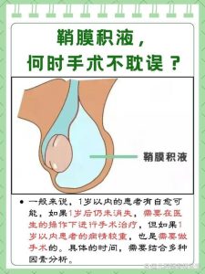 睾丸鞘膜积液需要手术吗-两性知识丨两性健康--你想了解的我都知道