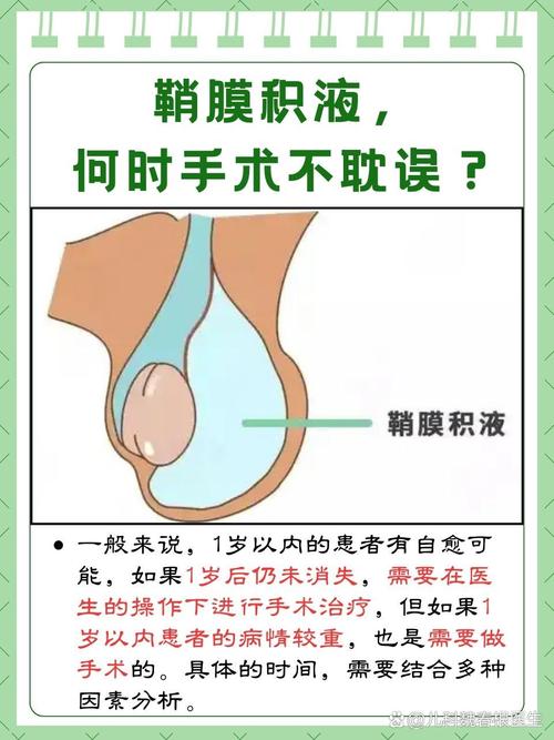 睾丸鞘膜积液需要手术吗