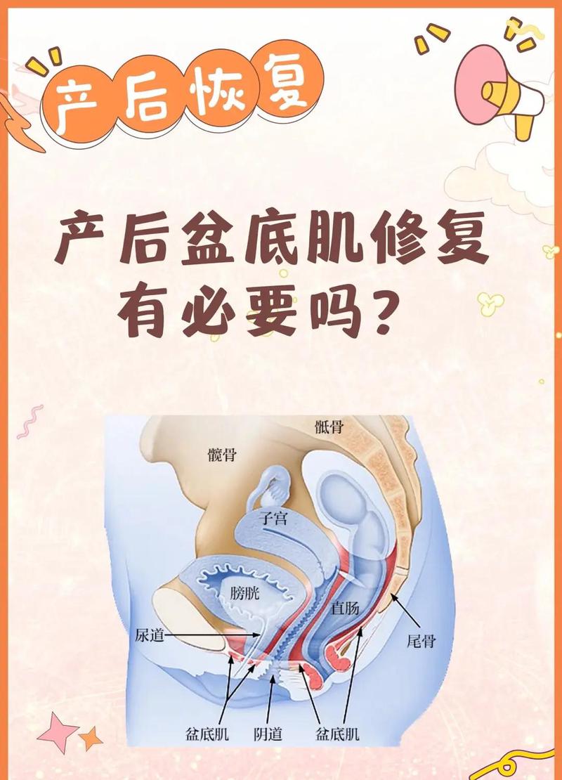 卵巢早衰要做盆底康复吗