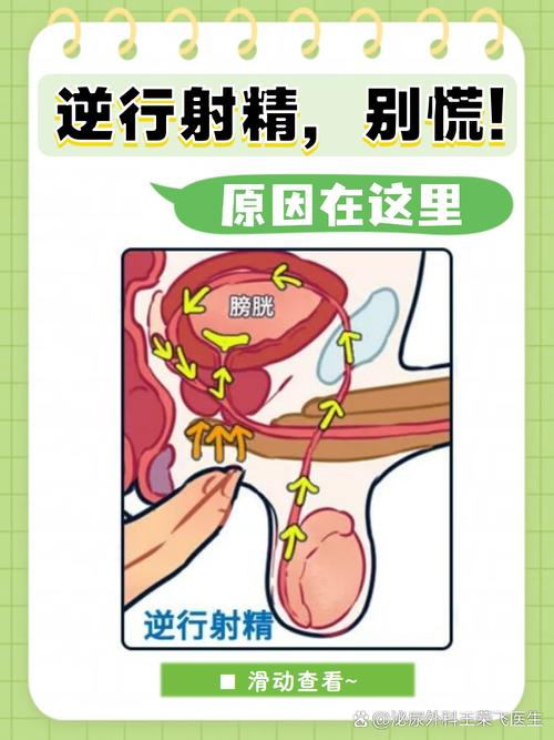 逆行射精是怎么回事