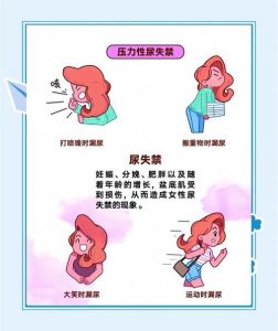 更年期漏尿会加重吗-两性知识丨两性健康--你想了解的我都知道