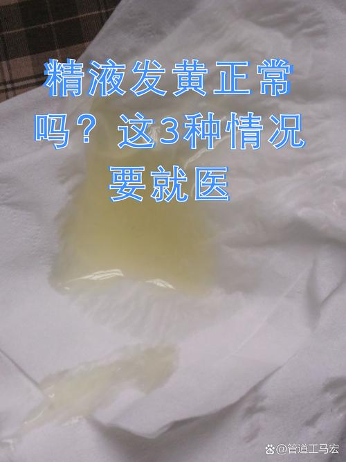 精液发黄是正常现象吗
