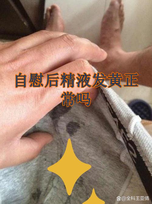 精液发黄是正常现象吗