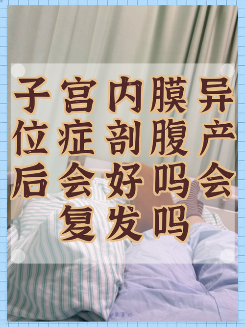 内异症患者产后会复发吗