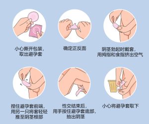 避孕套到底该怎么用才对?-两性知识丨两性健康--你想了解的我都知道