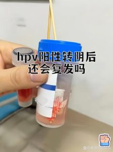 HPV转阴后还需要继续预防吗?这几点很多人都搞错了-两性知识丨两性健康--你想了解的我都知道