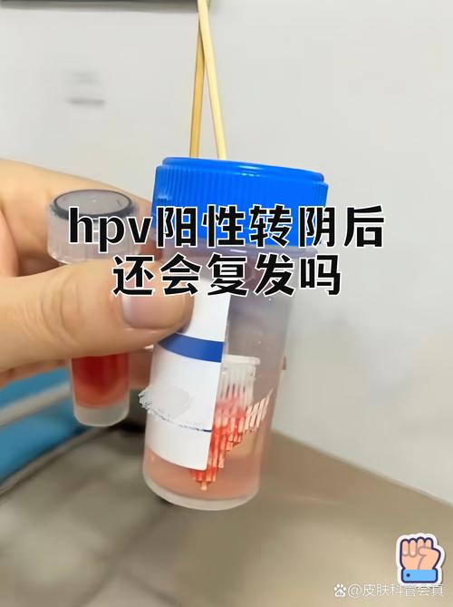 HPV转阴后还需要继续共防吗