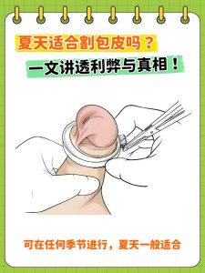 割包皮能让时间更长吗,别轻信传言-两性知识丨两性健康--你想了解的我都知道