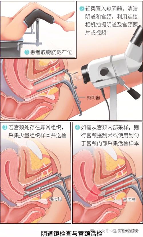 阴道镜活检能查出癌吗
