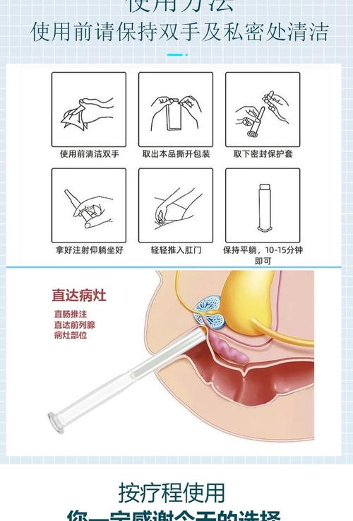男性避孕凝胶临床试验到哪一步了