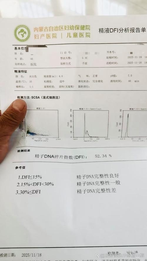 抗氧化治疗能降低精子碎片率吗