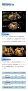 盆底超声到底能查出哪些毛病?-两性知识丨两性健康--你想了解的我都知道